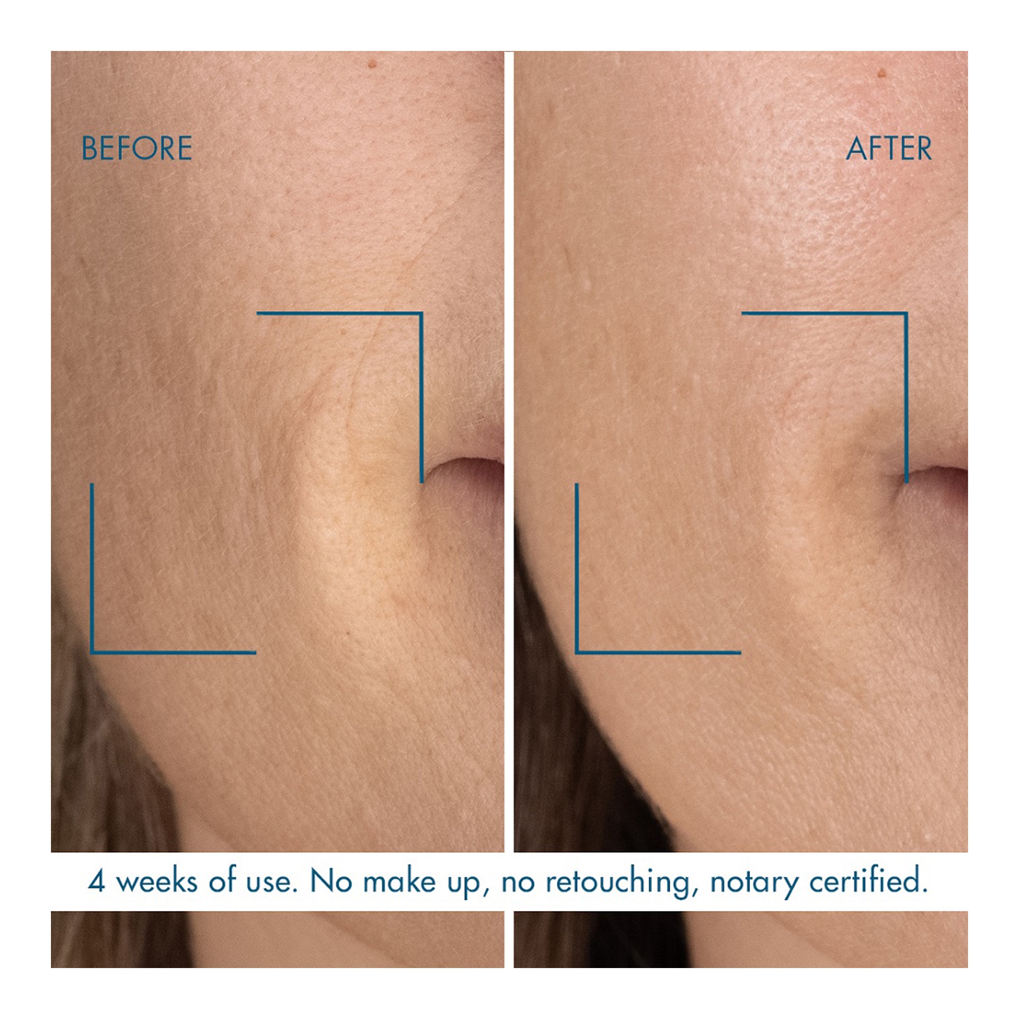 Blue Retinol ööseerum 30ml